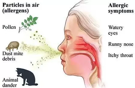 全国爱鼻日：务必揪出过敏原，避免过敏性鼻炎的加重和反复发作